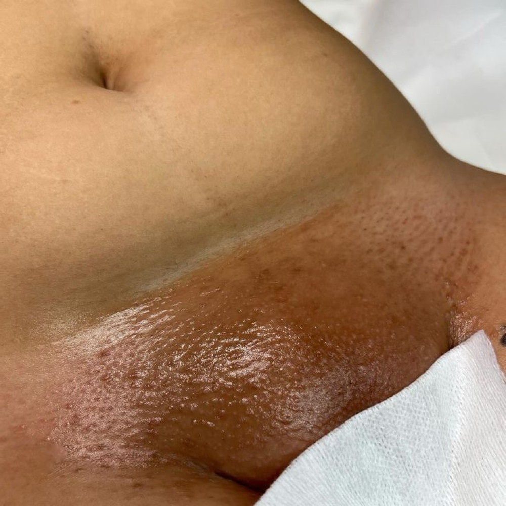 Brazilian (4-6 Weeks Only) at GlowedByMari in Houston, TX