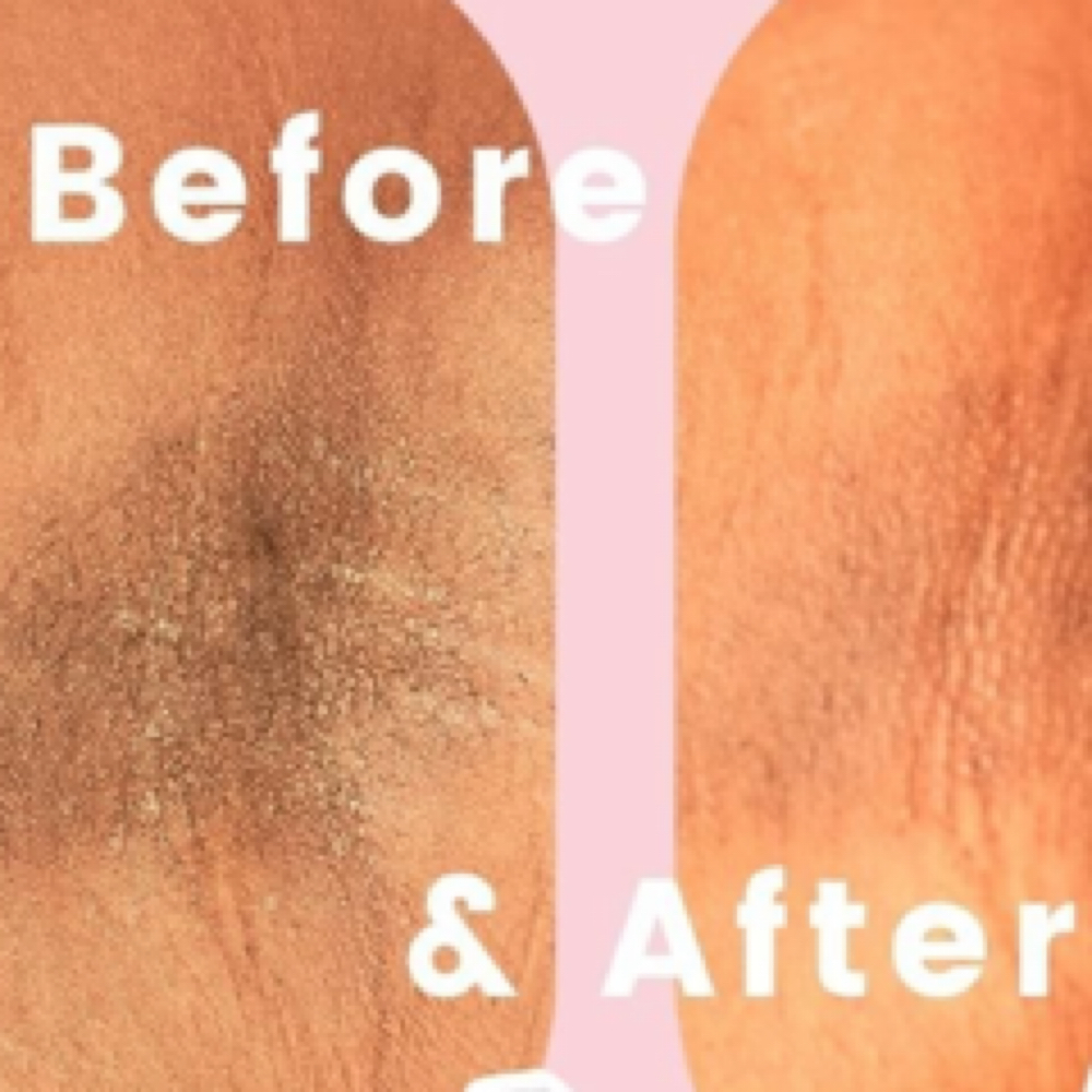 $65 New Client Brozilian 🍆 at Eso Y Mas in Dallas, TX