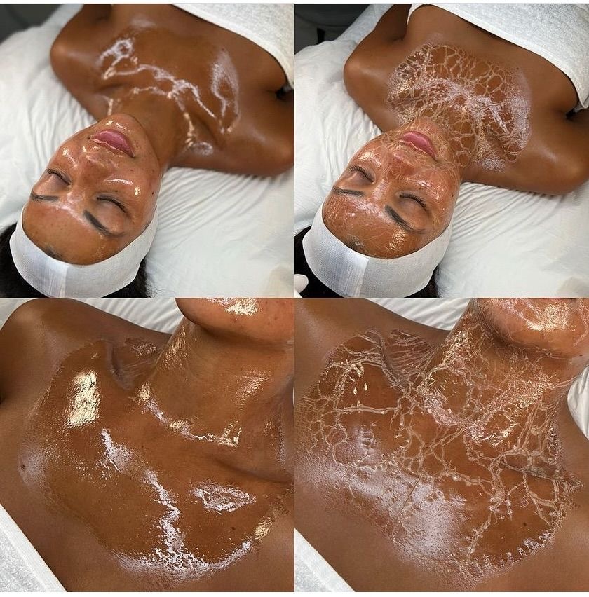 Firming Peptide aka Zombie Facial at Amore Skin Esthetics in Tempe, AZ
