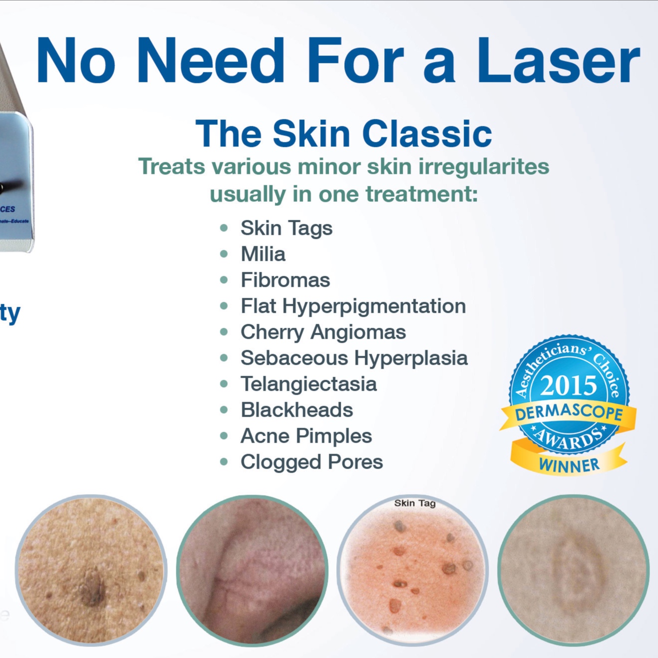 Skin Classic Treatment