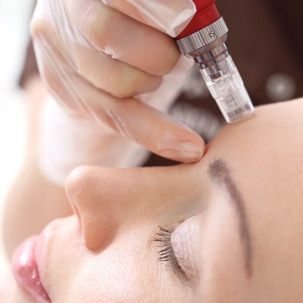 Microneedleing at The Virtuous Glow in Roswell, NM