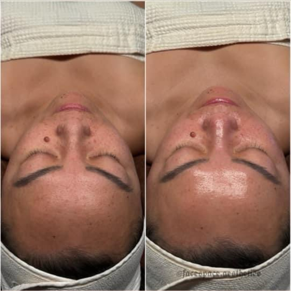 The K-Glow Glass Skin Facial