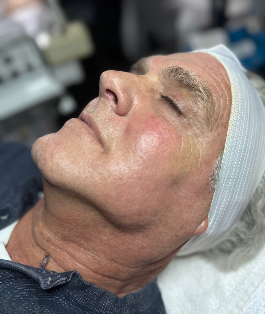 Anti-Aging Package (4 Facials)