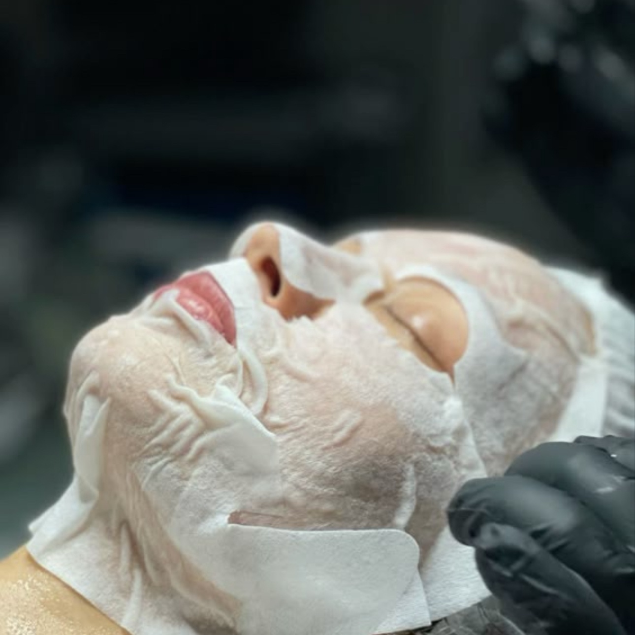 Hydrating Acne Treatment at Anastacia Beauty Lounge in Lake Park, FL