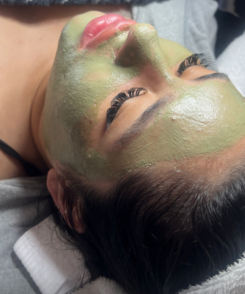 Acne Facial