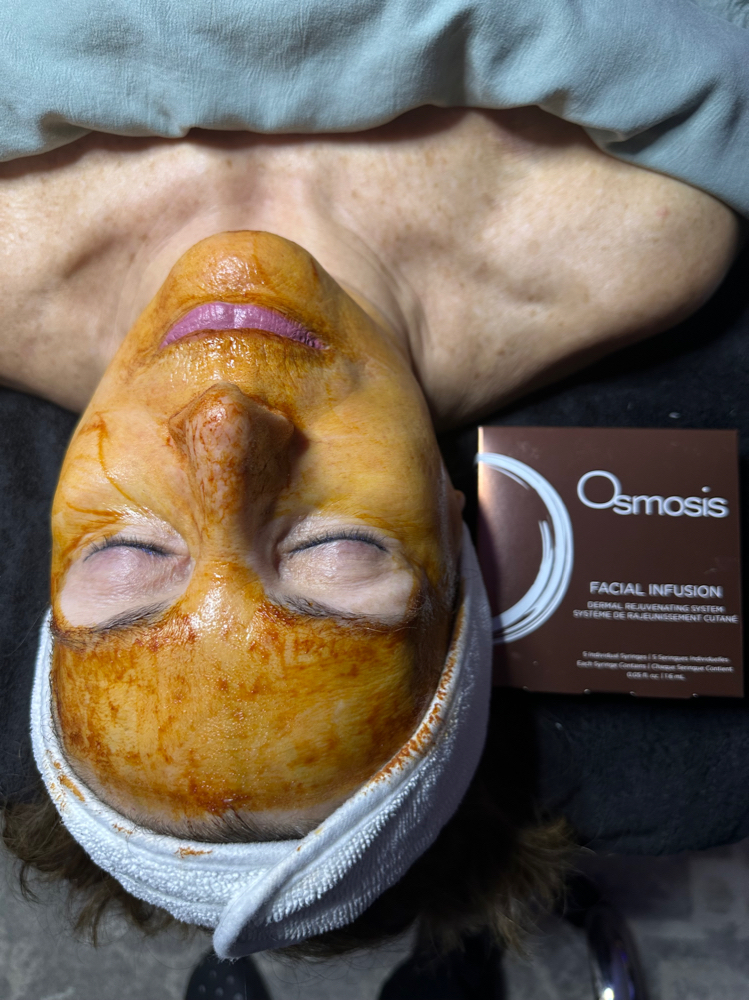 Osmosis Inf/ dermaplaning/LED