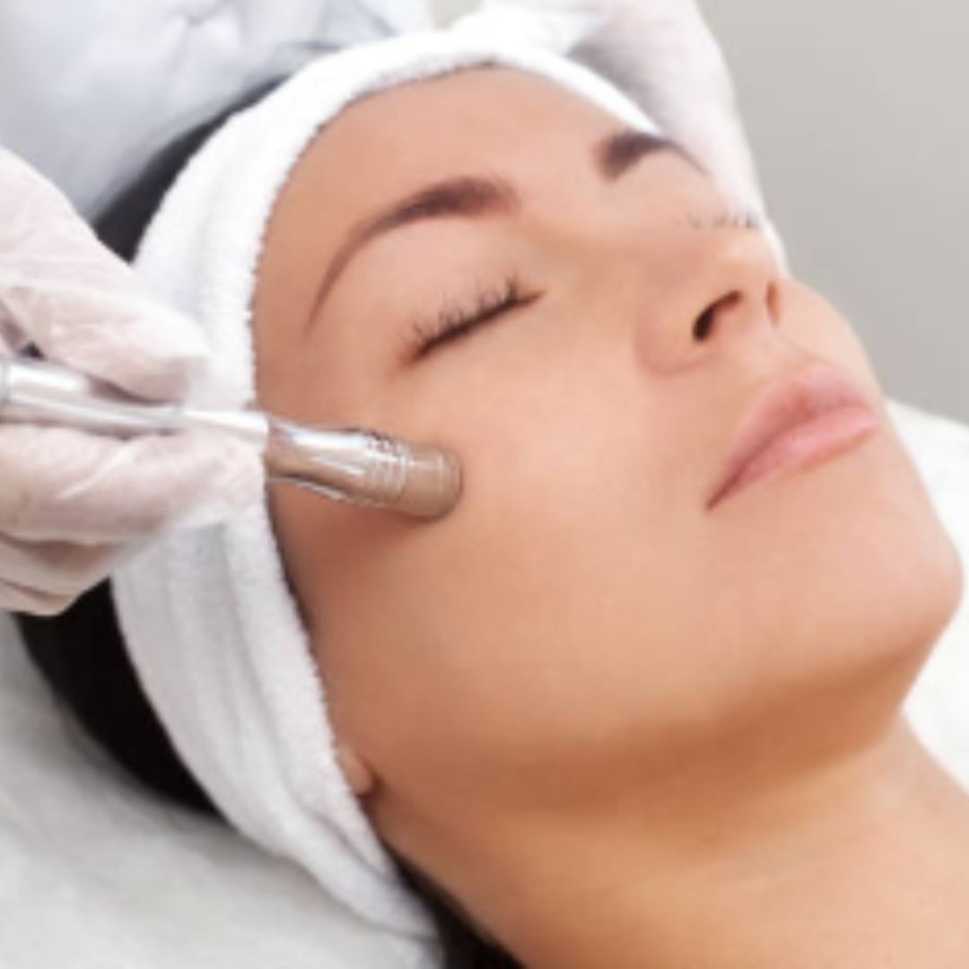 Microdermabrasion Upgrade at Pink Feather Esthetics in Peekskill, NY