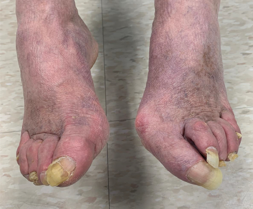 Medical Wellness Stage 4