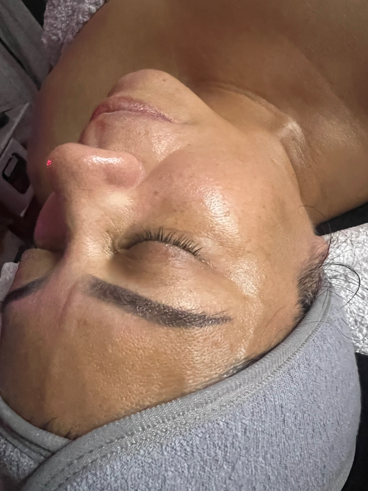 Facial With Microdermabrasion at Aesthetically You in Modesto, CA