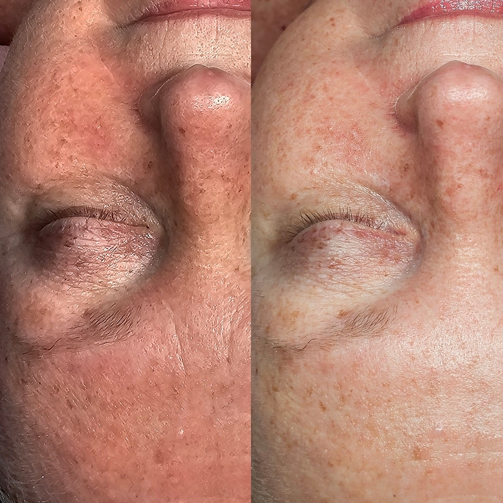 The Glow Up Facial at Aligned Beauty & Wellness in Davenport, IA