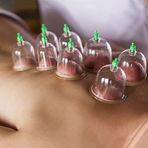 60 Minute Advanced Cupping Therapy