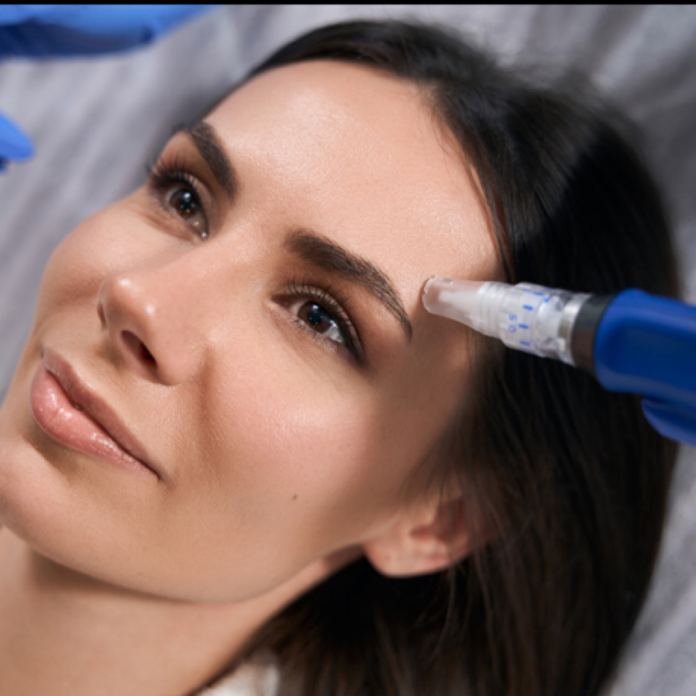 Microneedling Treatment at Bloom Aesthetics LLC in Fayetteville, NC