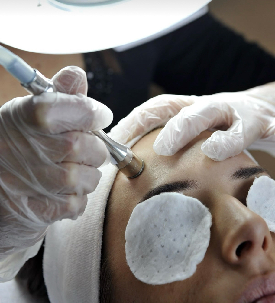 Microdermabrasion Treatment at Moon Massages By Beauty Glam Spa in Ansonia, CT