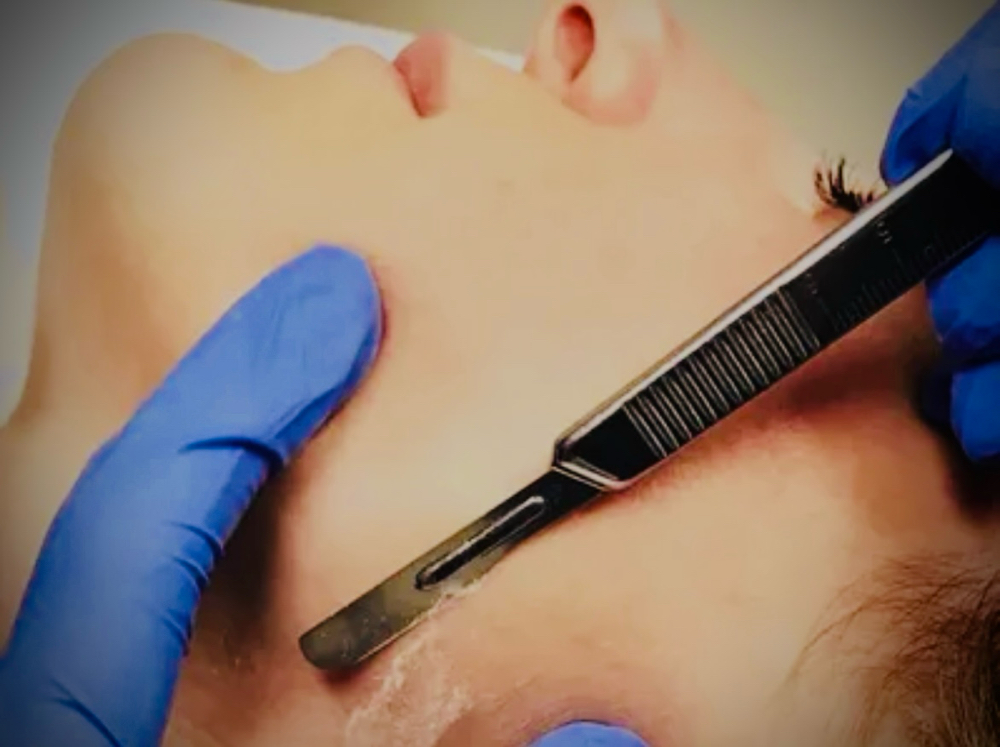 Dermaplaning Add On