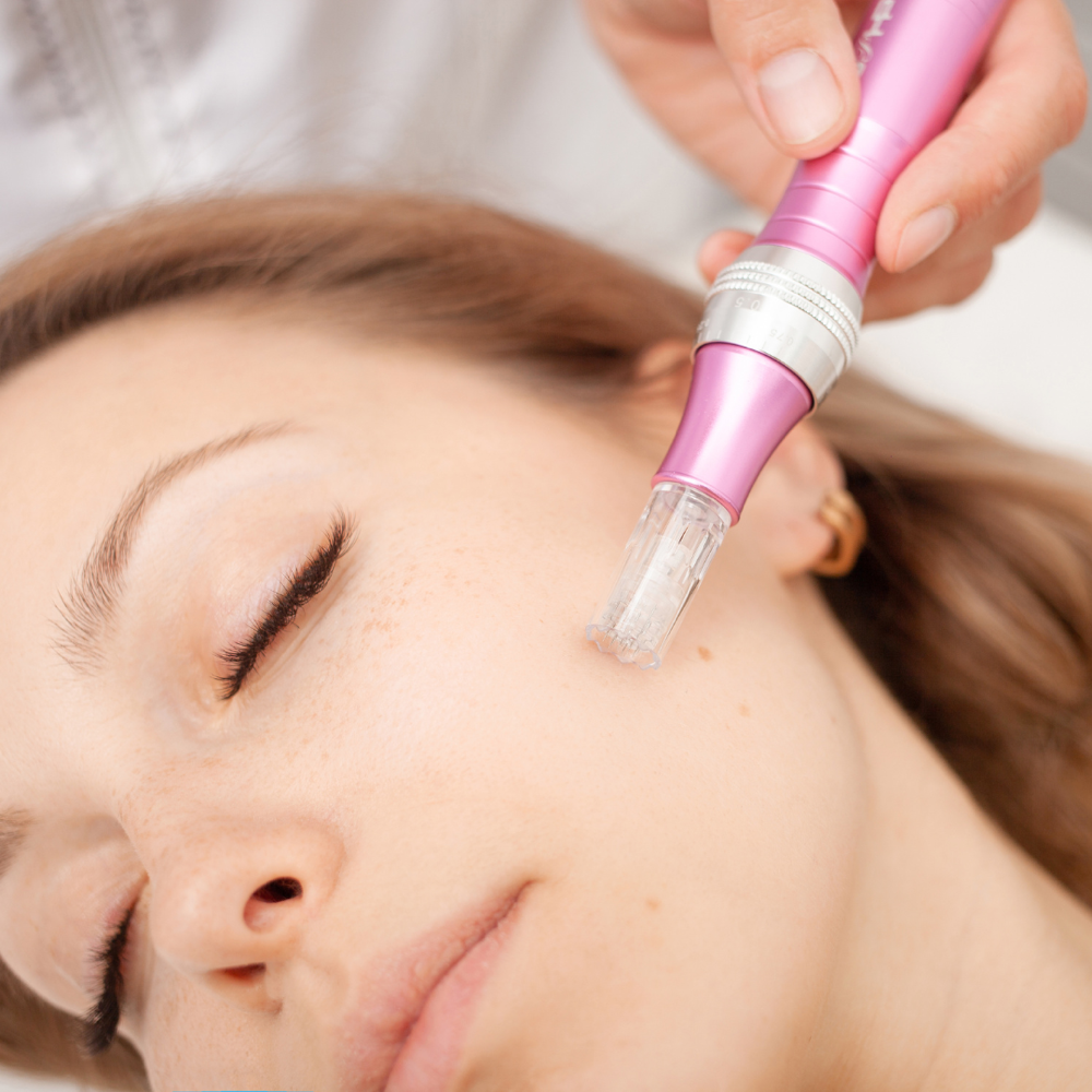 Microneedling Face + Neck