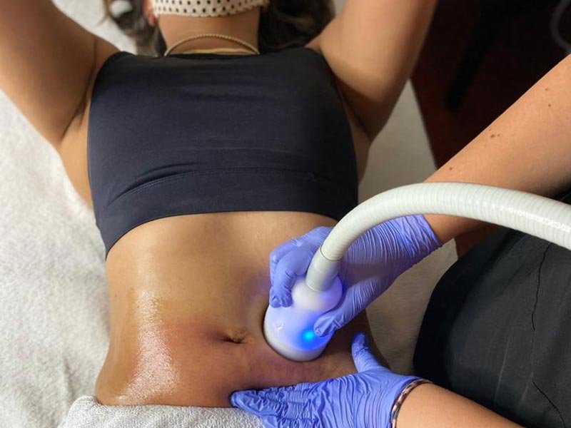 Cryoskin Slimming