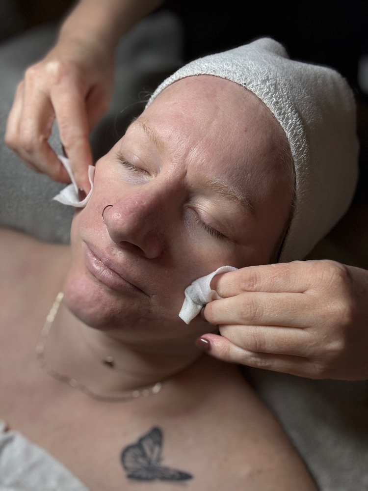 Chemical Peel Facial Add-On