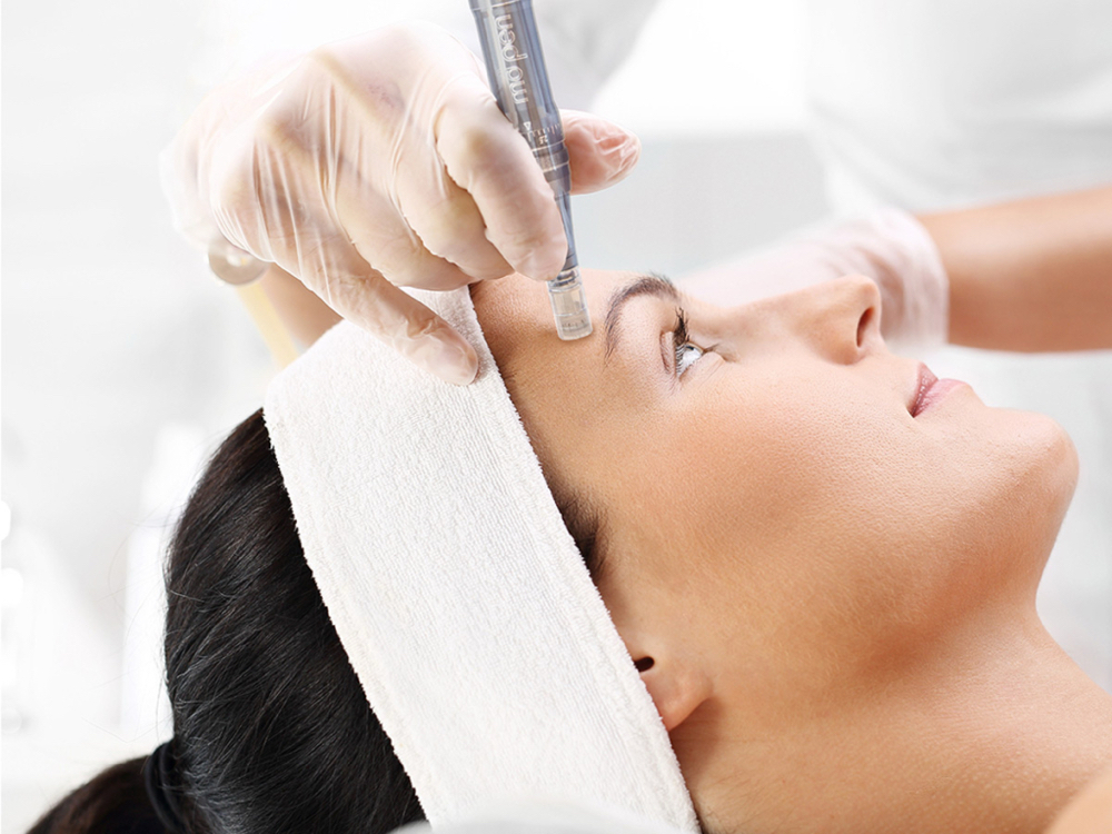 Nano-Needling w/choice of Serum
