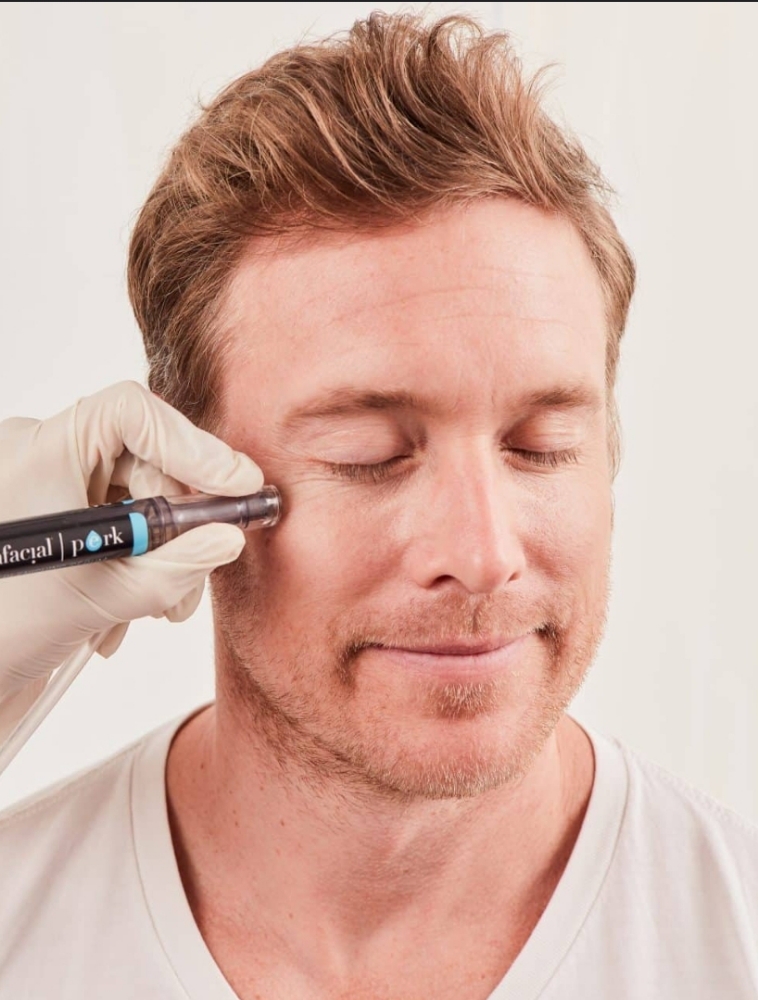 HydraFacial Eye Perk