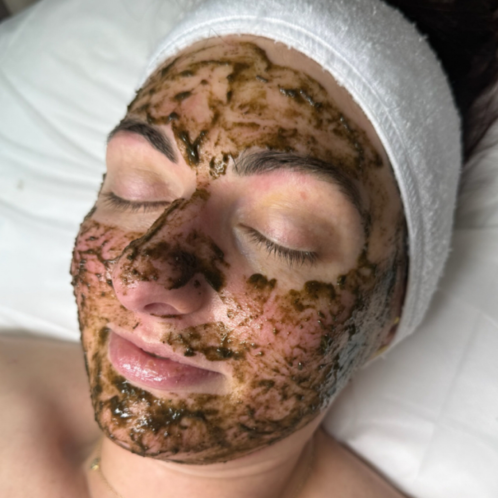 Beauty Peel at DermAdi Skin in Houston, TX