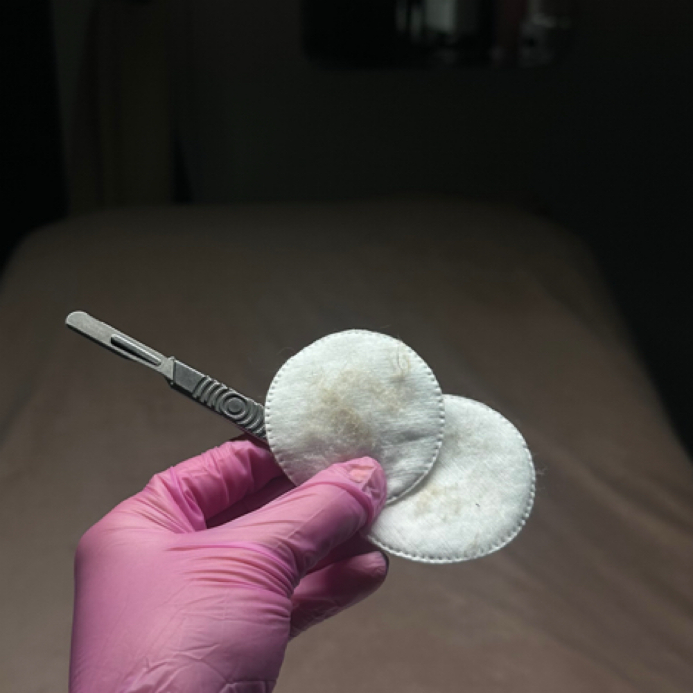 Glow-on-the-Go Treatment at Vain Aesthetics in Mendenhall, MS