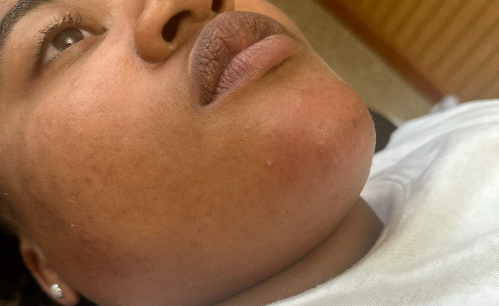 Chin & neck