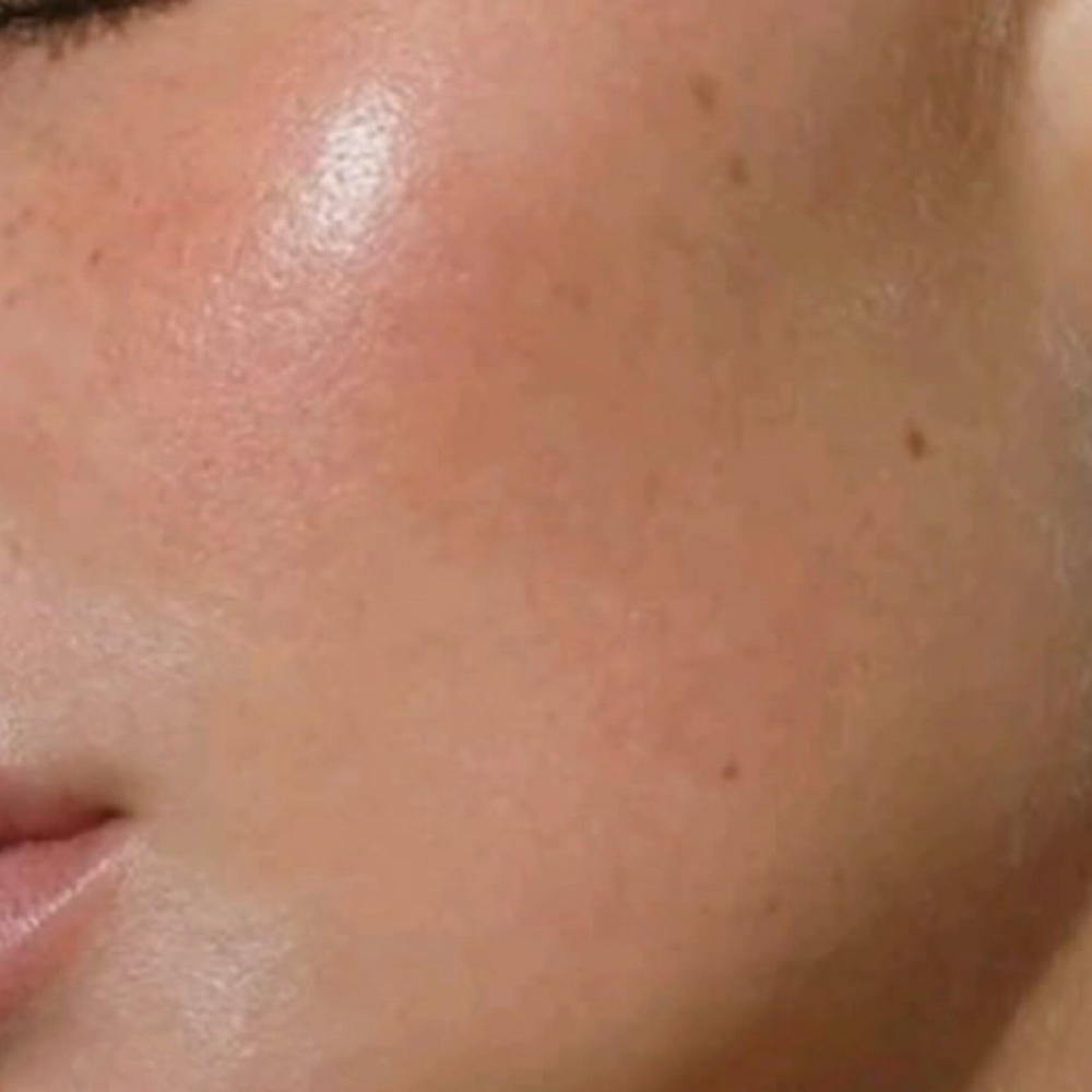 Sensitive Skin Facial at Pure Elegance Esthetics in North Andover, MA