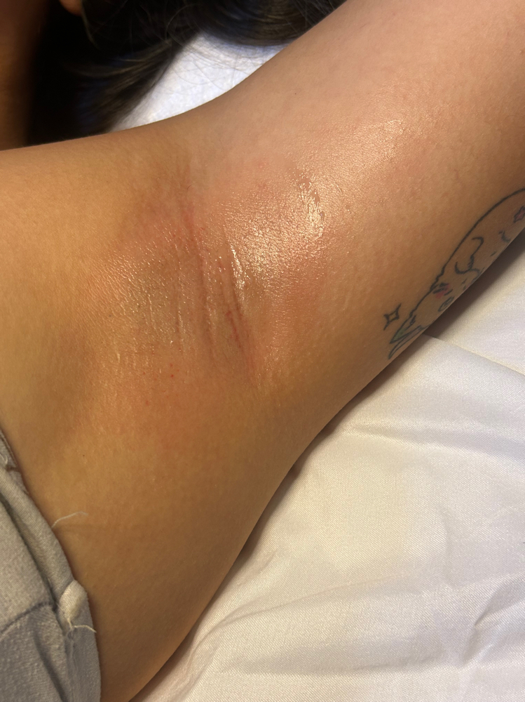 Underarm Wax at Anela Esthetics in Mountain View, HI