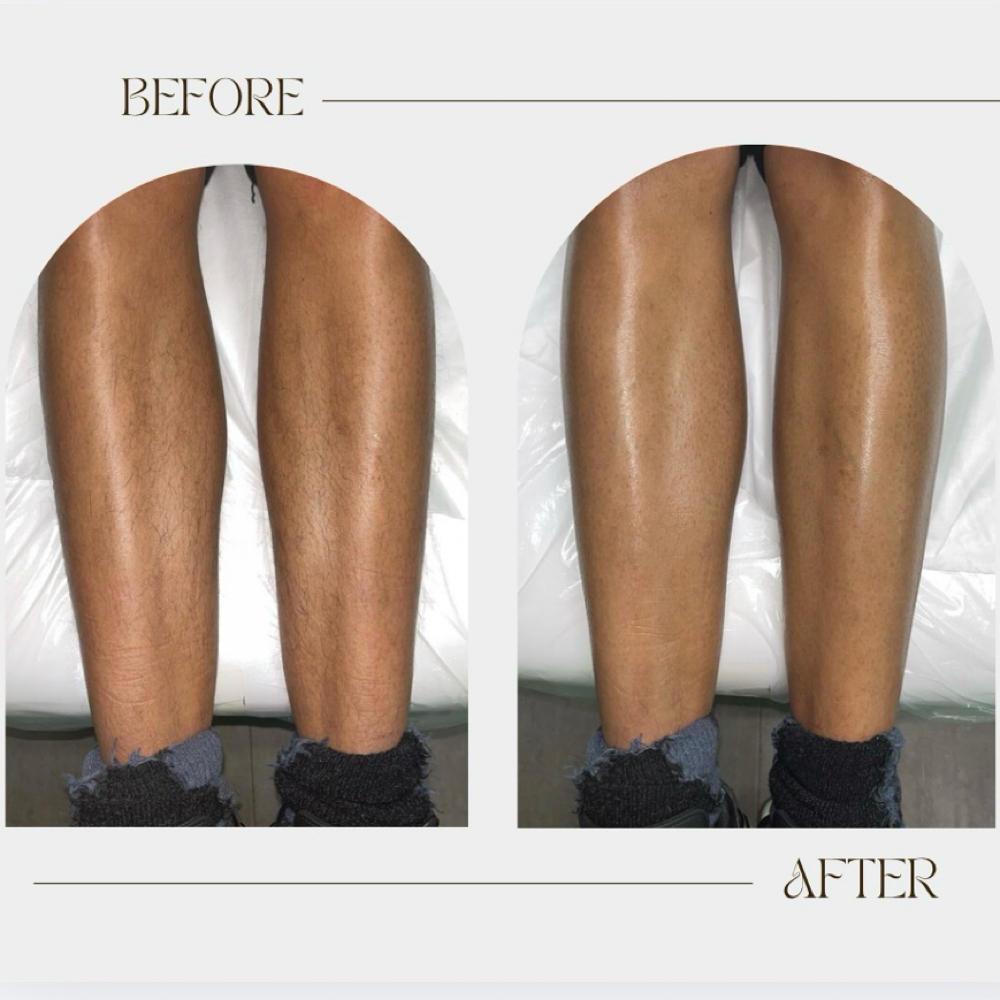 Lower Legs at SB Spa Break in Chicago, IL