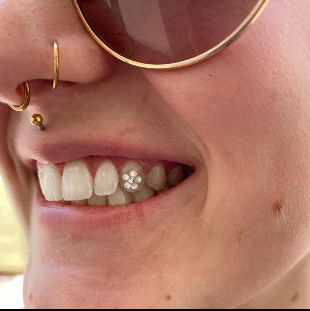 Flower Tooth Gem Design