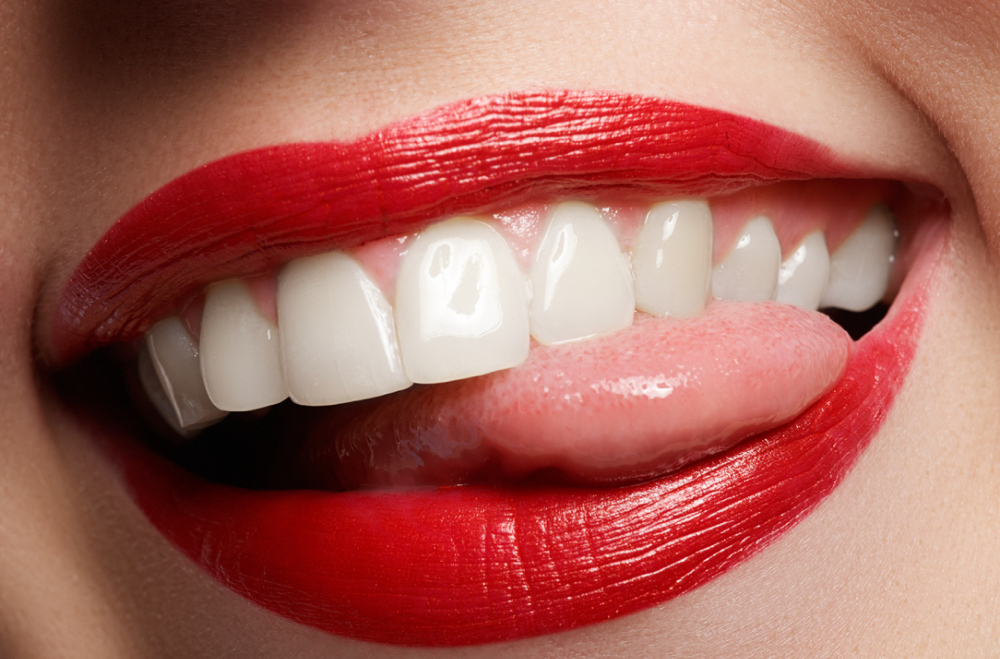 Express Laser Teeth Whitening