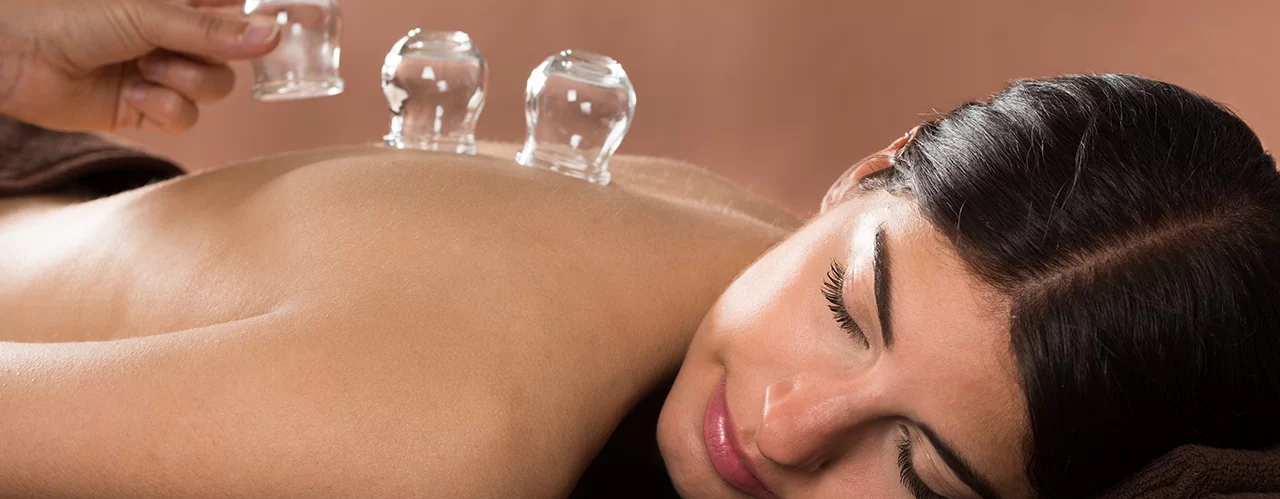 Cupping Massage Therapy