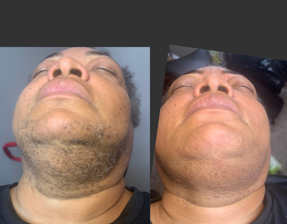 Chin Wax at Dio Artistry in Louisville, KY
