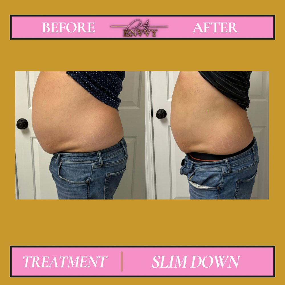 Slim Down (Stomach and Sides)