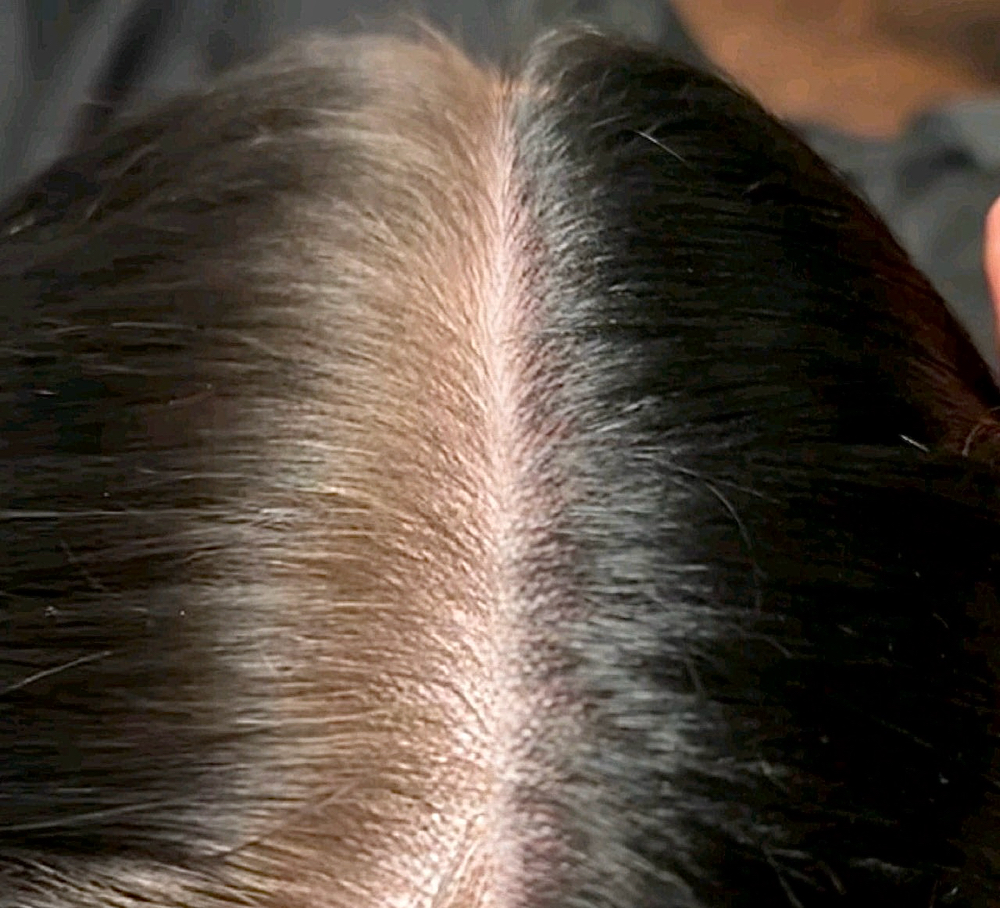 Root Touch Up