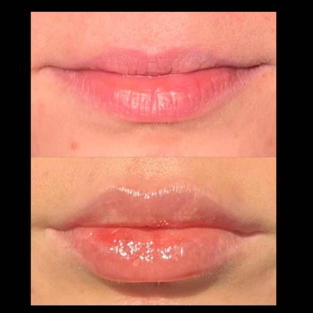 Signature Pout at Injections by Leighanna in Clarksville, IN