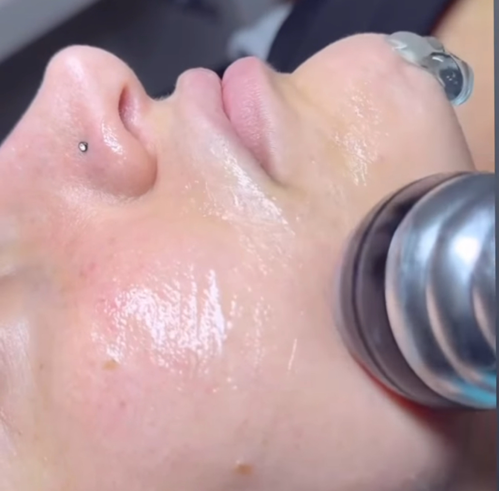 Ultrasound Renew & Lift Facial