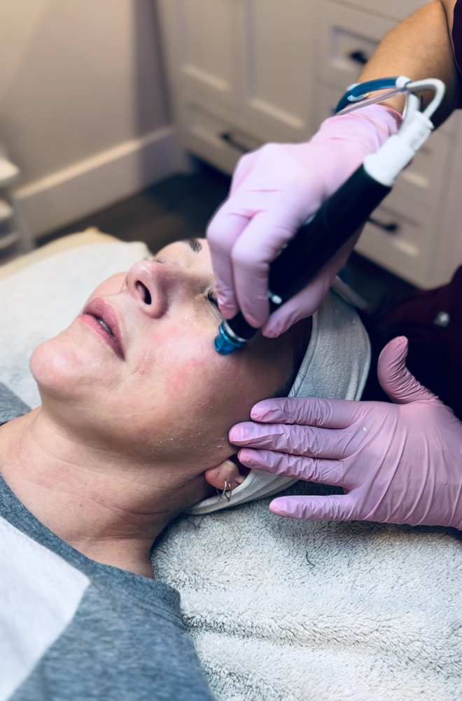Hydrafacial