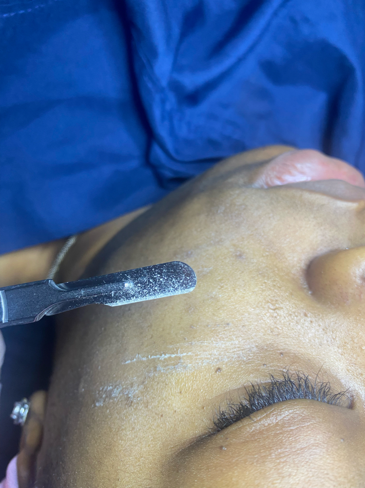 Dermaplane Facial