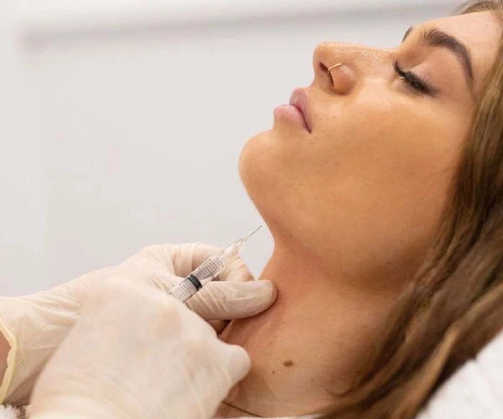 PCDC Fat Dissolve (Small Area) at Savy Aesthetics in San Antonio, TX