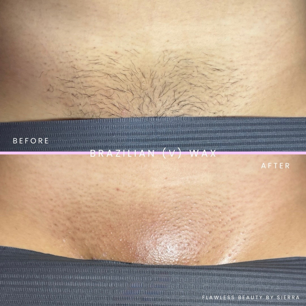 Brazillian (v) WAX at Flawless Beauty by Sierra in Roseville, CA