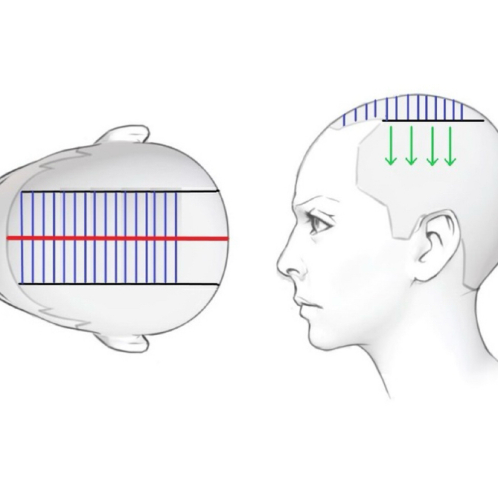 Partial Highlight at hairx_morgan in Bassett, NE