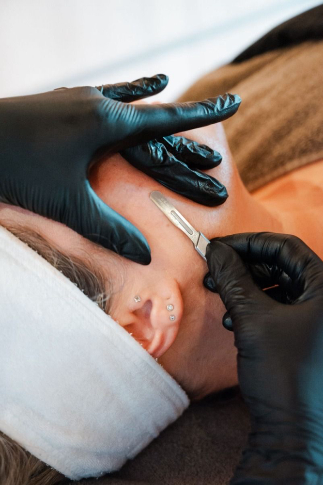 Dermaplane Facial at Skin Studio LLC in Pueblo, CO
