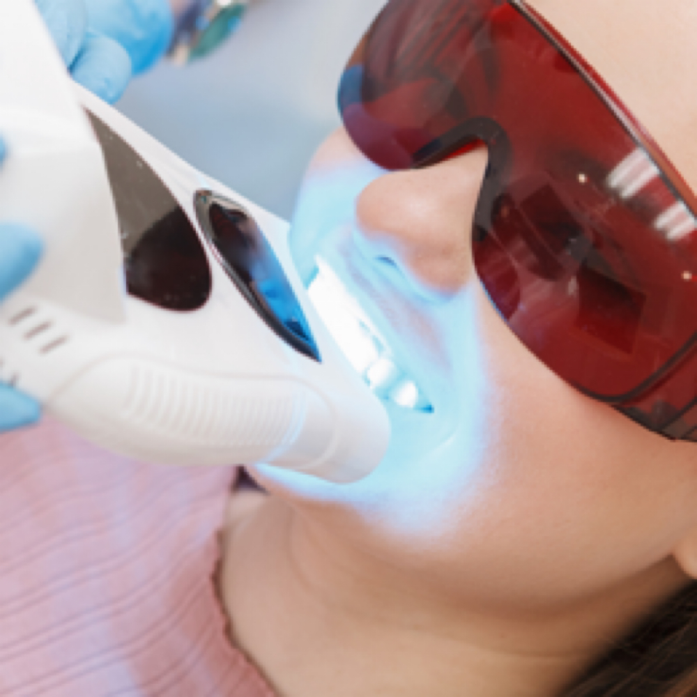 Teeth Whitening ( Express 20 min) at Brows by Lissette in Fishers, IN