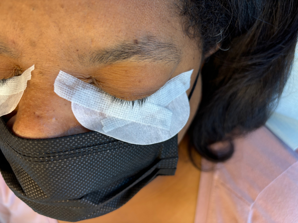 Lash Removal