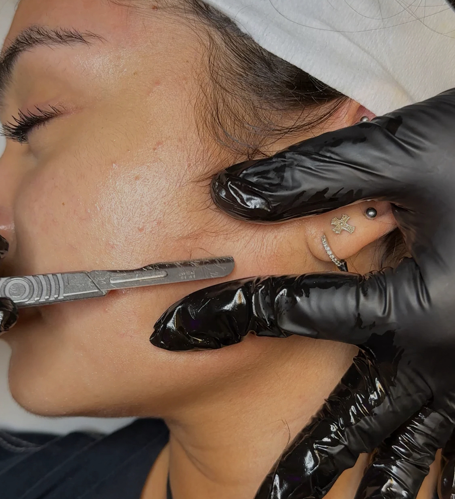 Dermaplaning Facial