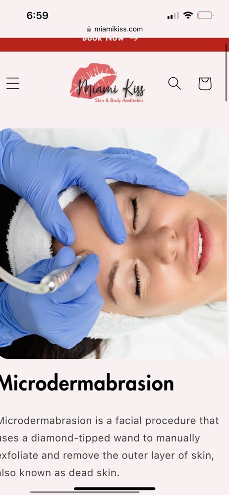 Microdermabrasion