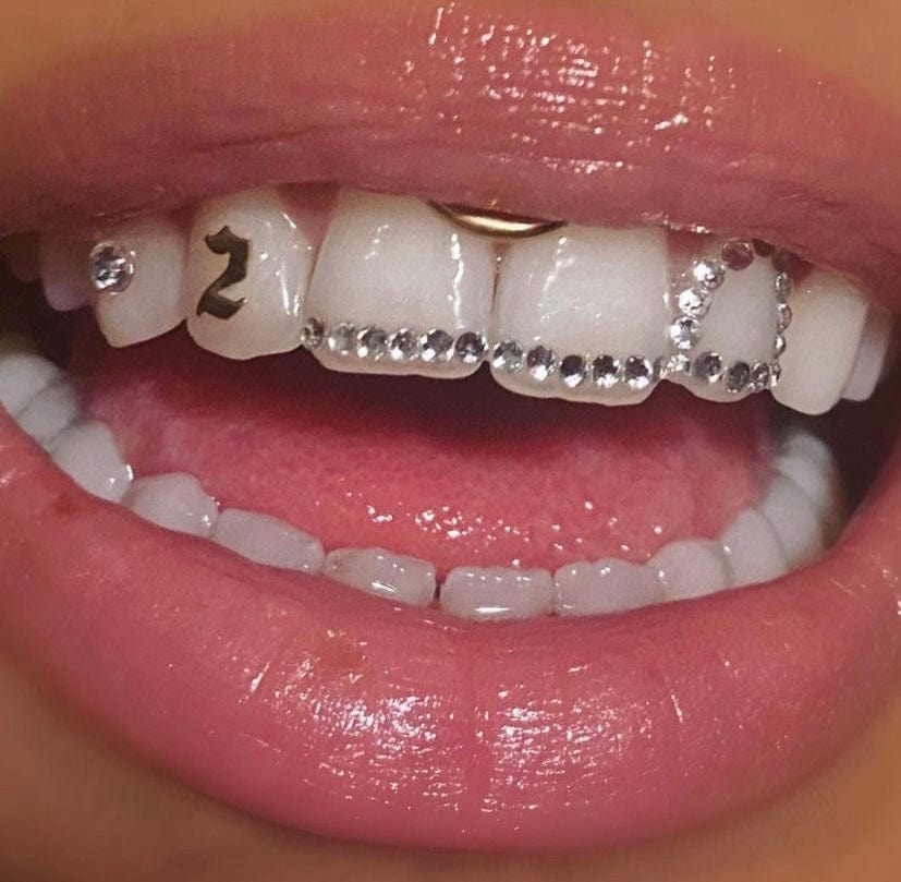 Permanent Tooth Gems