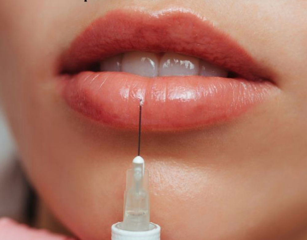 Half Syringe Lip Filler