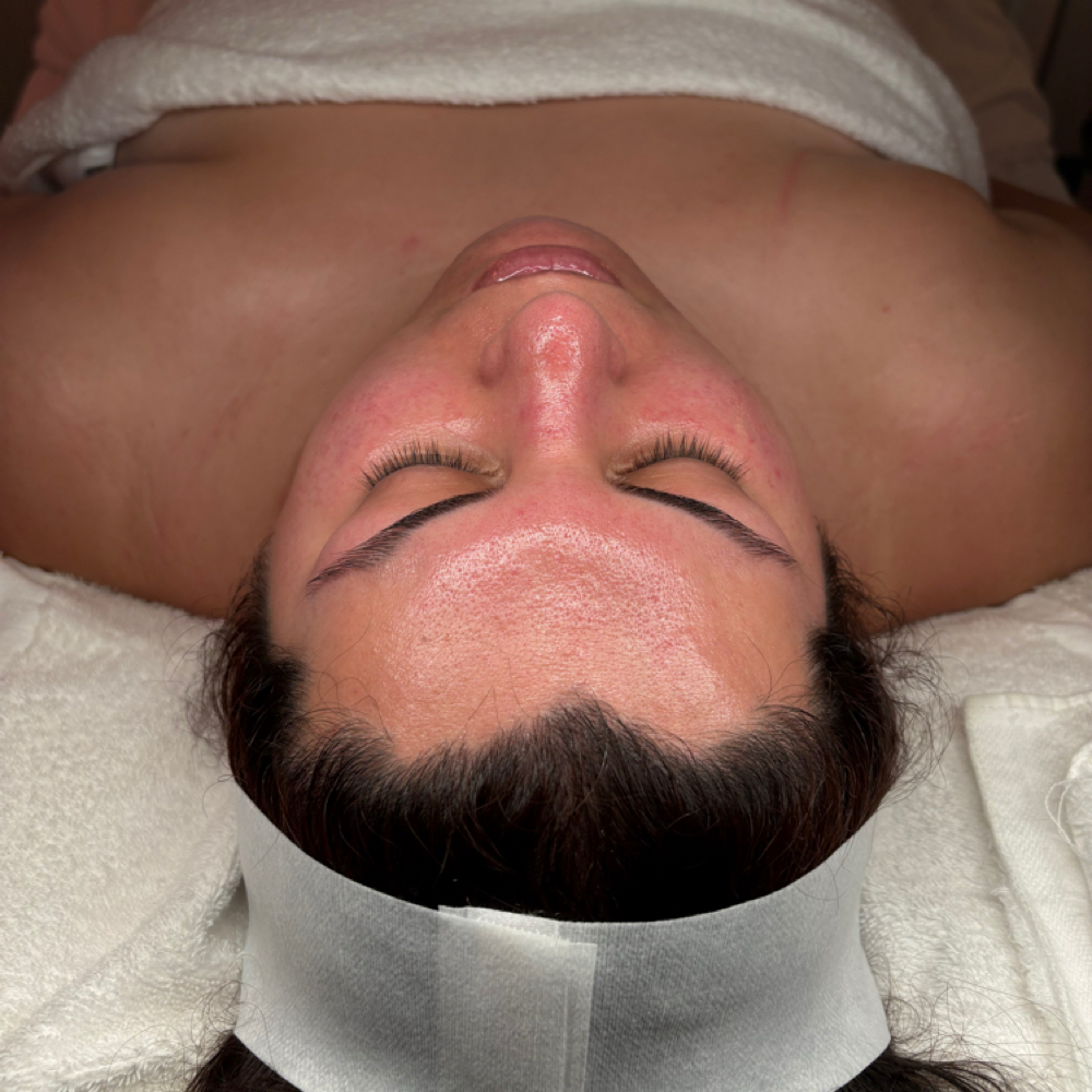 New Client Consult + Facial at Euphoria Skin in Chandler, AZ